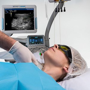 Prostate - Echolaser