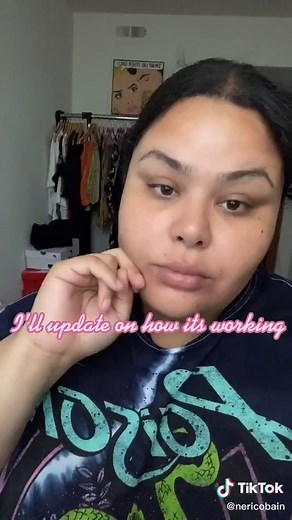 IPL Lux Skin Laser Hair Remover Review & Updates