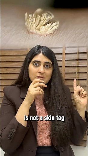 Warts Treatment at Home| How to prevent Warts? Dermatologist explains Wart Removal|