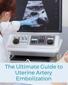 The Ultimate Guide to Uterine Artery Embolization