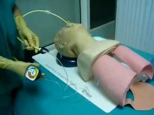 CooK Catheter airway exchange throught ET+Jet Ventilation.