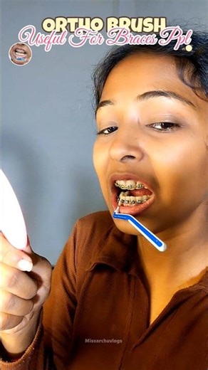 😍📦Mini Braces Brush || Mera partner 🤣🤭 #ytshorts #bracestool