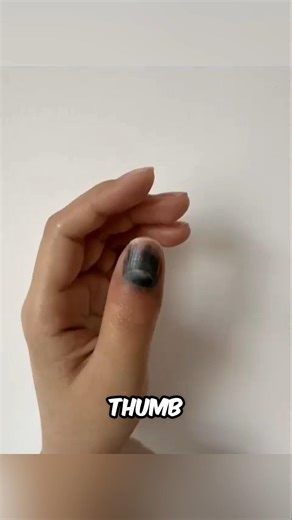 This Girl Created the Timelapse of her Bruised Nail 🤯