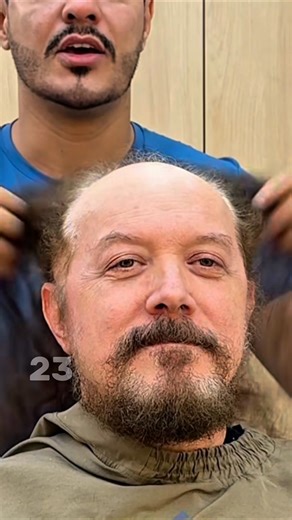 This Man With Long Thin Hair Got a Full Hair Transformation and Looks 20 Years Younger After... Results in Comments 👇👇👇 | Interesting Stories