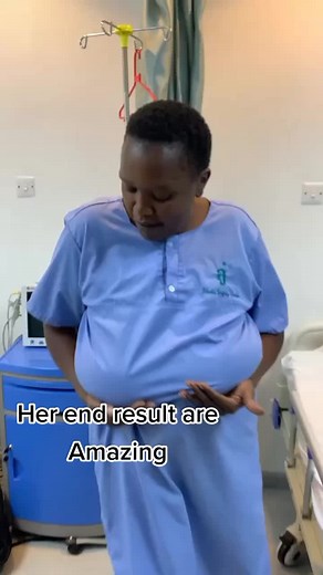 #gigantomastiafoundation