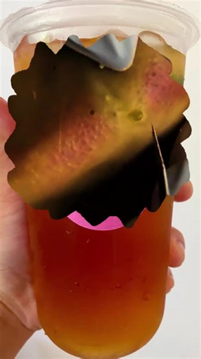 #squeezeyuk #pimple #satisfying | pimples videos