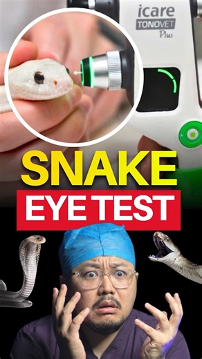 This Snake Needs Eye Drops Daily 😂🐍