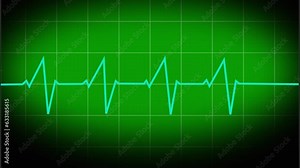 A vector-based image Heartbeat ECG display. The heartbeat. Electrocardiogram. a single pulse line. Cardiogram, or heart pulse line wave, or ECG. history of electrocardiogram in medicine.