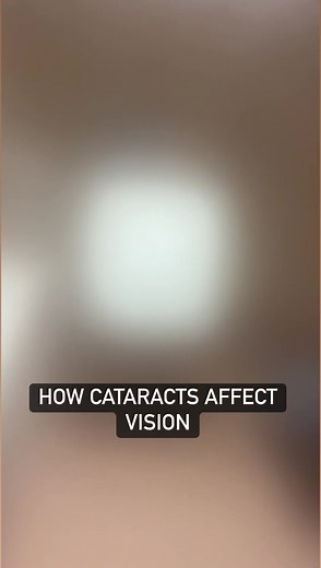 Cataract Vision Simulation #cataracts #vision #simulation #eyechart | Blind on the Move
