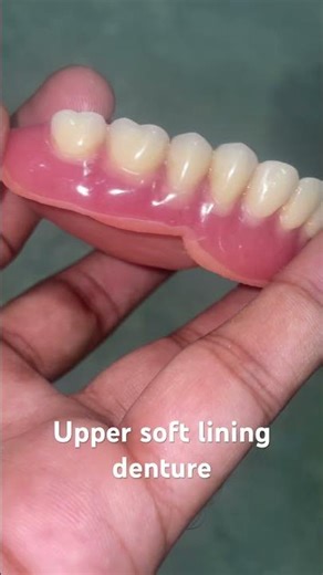 Upper soft lining denture 😬😬😬#apexdental #partialdenture #splittooth #dentistry #orthodontist