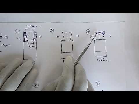 Maxillary Canine Carving on Wax block part 1 by Dr. Kamlesh Dekate