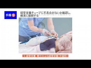 1 5 胃ろうによる経管栄養（半固形）