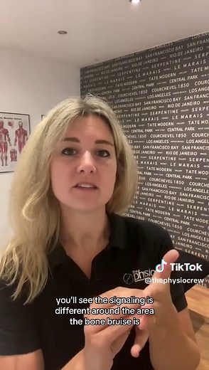 🦴What is a bone bruise? 🦴 What does a bone bruise look like? Do i have a bone bruise? #thephysiocrew #Physiotherapy #sportstherapy #bonebruise #bonebruising #sports