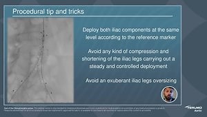 Clinical Insights: 19 Year Outcomes with the Anaconda Stent Graft System