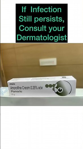 Best creams for fungal infection |Skin fungus treatment| Dr Ashima Goel MD| ringworm treatment|Tinea