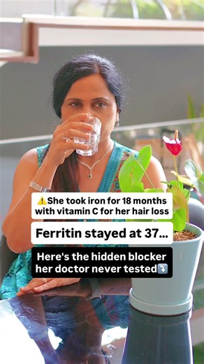 Iron, Ferritin, Inflammation, and Hair Loss