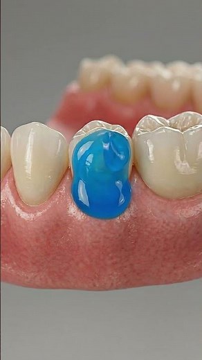 Gum Line Tooth Repair 🦷 3D Dental Animation