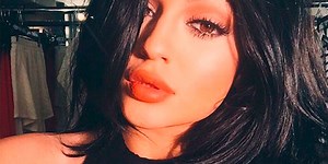 20 cosas que debes saber antes de ponerte relleno en los labios (y podrían hacerte cambiar de opinión)