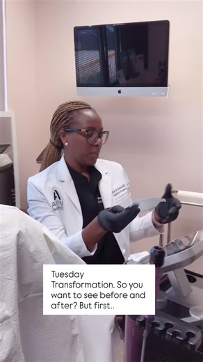Today’s Tuesday Transformation is a little twist — not a before-and-after photo, but a behind-the-scenes look at how we prep for Votiva vaginal rejuvenation. This treatment is a powerful, non-invasive way to support intimacy, sensation, lubrication, and pelvic wellness. With the holiday season in full swing, sometimes the best gift is feeling like yourself again. Confident. Balanced. Rejuvenated. Whether it’s performance, pleasure, or overall feminine health — we’re here to help you tune up, glo