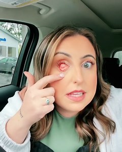 637K views · 5.2K reactions | Rachel is so proud of her prosthetic eye - I think it looks so cool!  | Tyla | Facebook