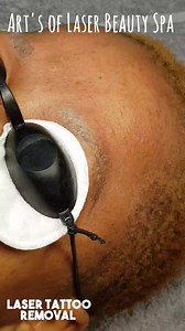 30K views · 80 reactions | Fixing a bad shaped Eyebrow Tattoos is not about saving money. Fixing bad permanent makeup is about saving your face, protecting your appearance and preserving your positive, self-image for years to come. #tattoremovalbotswana #artsoflaserbeautyspa #artsoflaser #badpermanentmakeup | Arts Of Laser Beauty Spa | Facebook