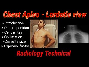 Chest Apico - Lordotic View X-Ray # Chest radiography ## || By BL Kumawat #