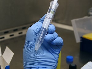 An Efficient and High Yield Method for Isolation of Mouse Dendritic Cell Subsets