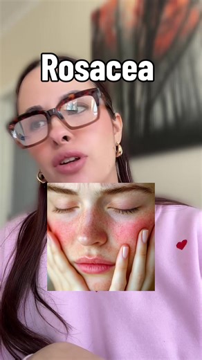 Understanding Rosacea: Causes, Symptoms, and Treatments