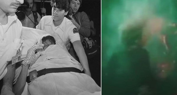 What happened after Michael Jackson's hair caught fire during a Pepsi advert