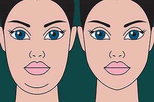 How To Get Rid of Neck Fat