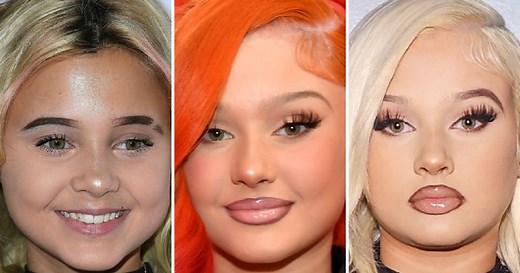 Did Alabama Barker Get Plastic Surgery? Travis Barker and Shanna Moakler’s Daughter’s Transformation