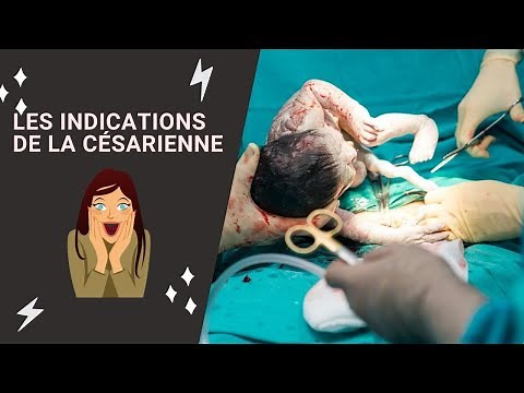 Indications de la césarienne