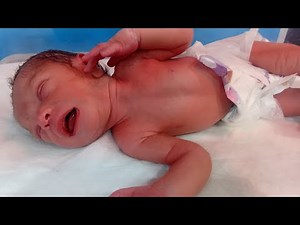 NICU Nurse🩺💉 is live33 Weeks Preterm Low Birth Weight Baby | NICU Live Care | Educational