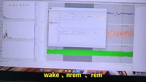 今天简单分享下关于使用pinnacle软件分析小鼠睡眠状态是怎么分析的
