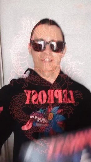 2.7K views · 191 reactions | LEPROSY en Houston e Irving Texas | Fans Leprosy | Facebook