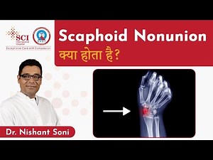 Scaphoid Nonunion क्या होता है? | Dr. Nishant Soni | SCI Hospital
