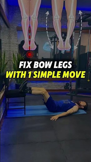 One Easy Exercise to Correct Bow Legs (At Home No Equipment)