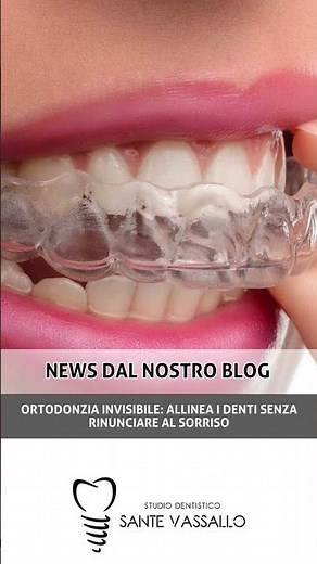 Ortodonzia invisibile: allinea i denti senza rinunciare al sorriso