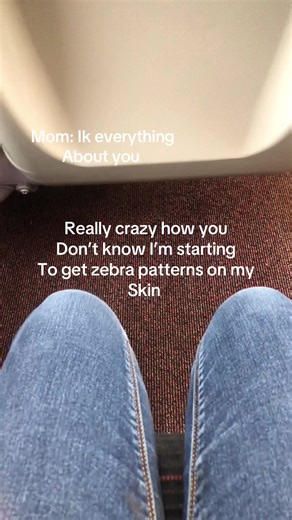 Mother and Child Revelation: Zebra Patterns on Skin