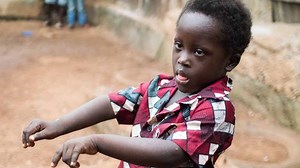 ‘Devil Boy’: Down’s syndrome in Sierra Leone