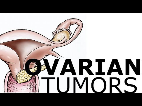 Ovarian Pathology & Tumors