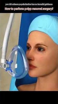 Polyp Removal Surgery (3D Animation)#polypremoval #polyp #colonsurgery #digestivesurgery