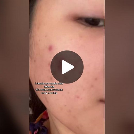 Achieve Radiant Skin with Whitamin C Day Cream and Spot Serum!