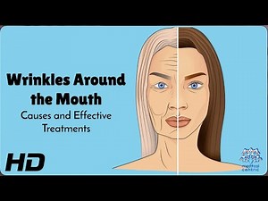 Mouth Wrinkles? Causes & Fixes You Need to Know! 👄✨