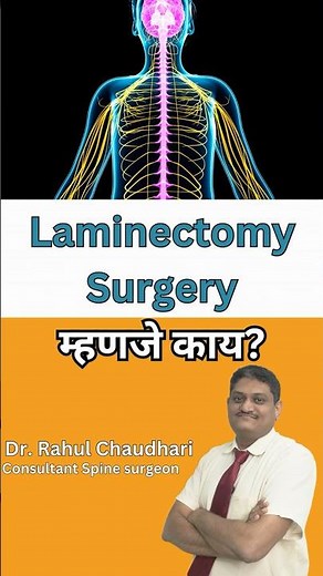 What is Laminectomy Surgery? Dr. Rahul Chaudhari, Best Spine Surgeon at Manipal Hospital