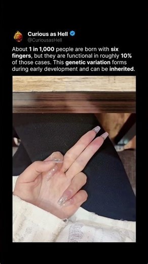 The Science Behind Six Fingers 🧬