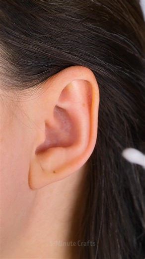 500K views · 1.1K reactions | The easiest first aid hacks  | 5-Minute Crafts | Facebook