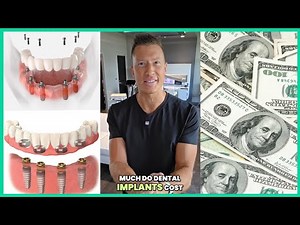 How Much Do Dental Implants REALLY Cost in 2025? Full Mouth Pricing Revealed - Affordable Payment