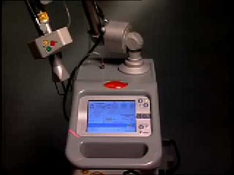 DOT Therapy Smartxide CO2 Laser Resurfacing