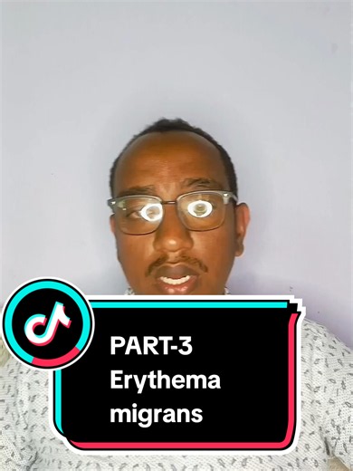 PART-3#Erythema migrans#dermatology#USMLE high yields